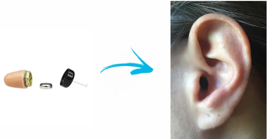 Micro auricolari bluetooth: scopriamo di cosa si tratta